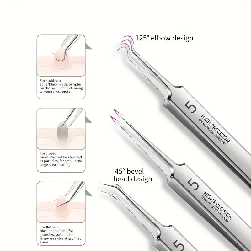 1 Pack Extra Fine No. 5 Cellular Acne Blackhead Tweezers - Facial Beauty Remove Acne Needle Tools for Skin Care